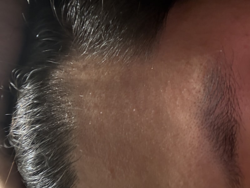 닥터포헤어 폴리젠 씨크닝 스칼프 세럼 2주차 후기