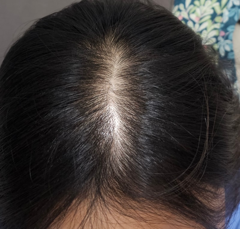 더후  후스파 스칼프 안티에이징 헤어리프팅 샴푸 3주차 후기