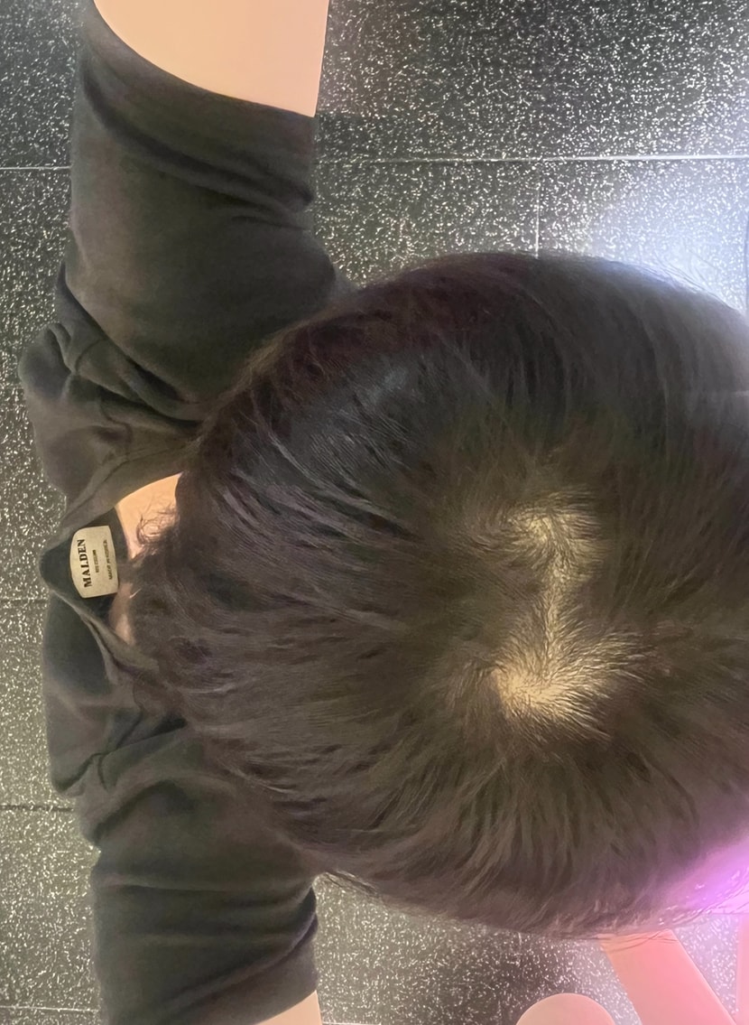 고민부위, 전체