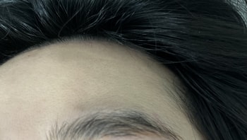 이마라인(오른쪽)