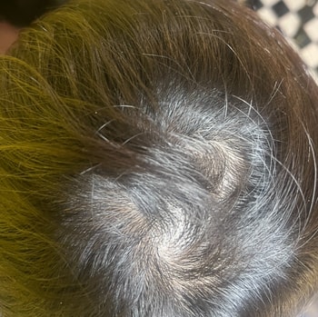 정수리