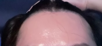 이마라인
