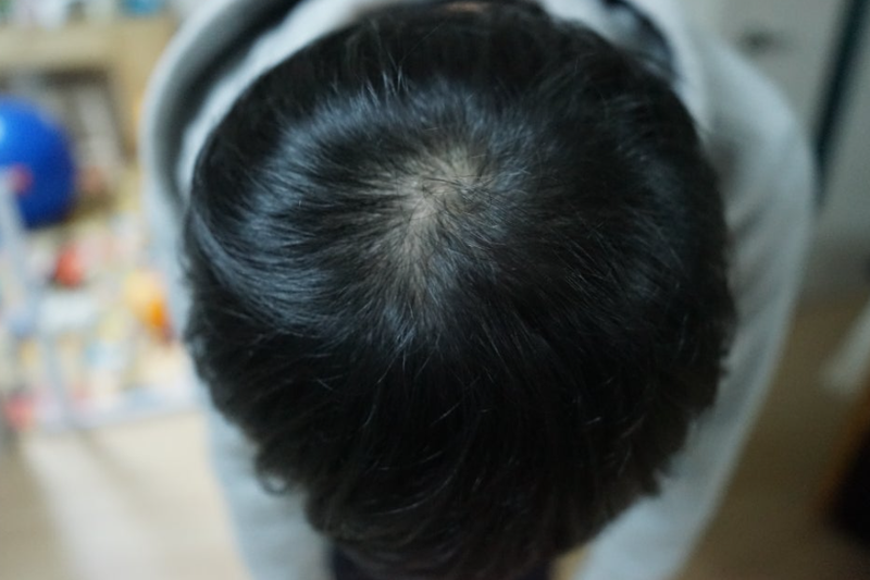 HAUM 탈모샴푸 2주차 후기