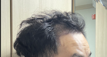 Dr.For Hair 4周使用评价