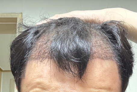 닥터포헤어 3주차 사용 리뷰