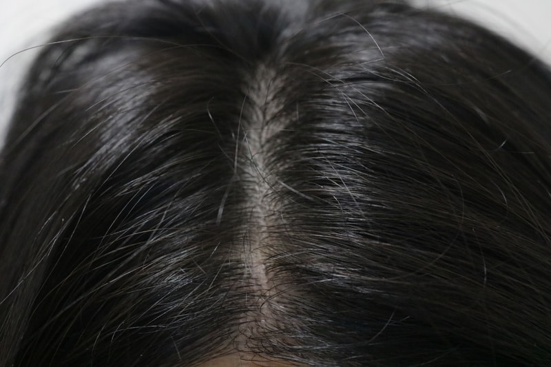 オンユビオチン4週目の体験談です。