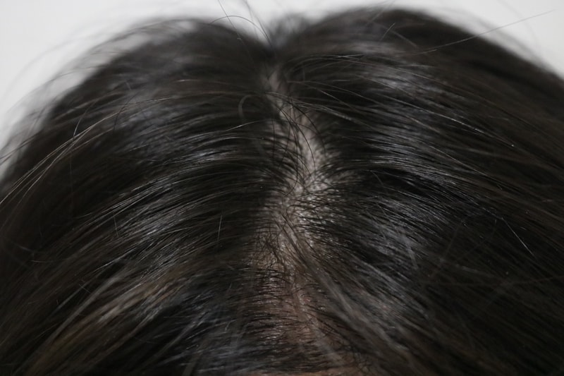 オンユビオチン3週目の体験談です。