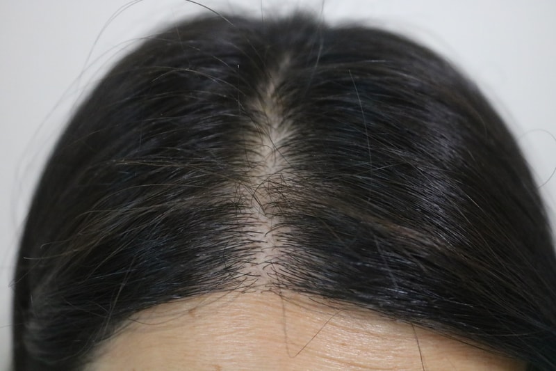 하움 샴푸 2주차 후기