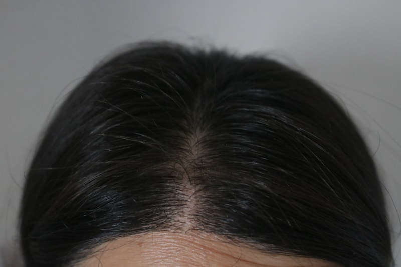 려 루트젠 두피 에센스 2주차 후기