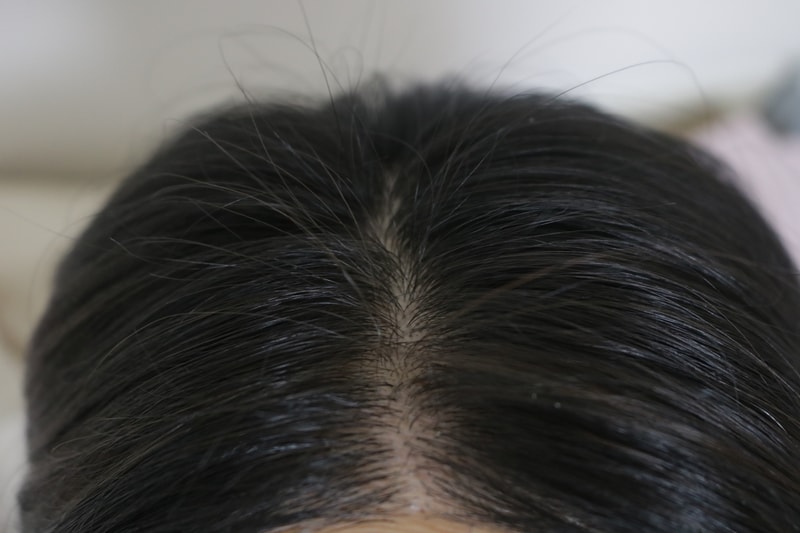 Hair Miracle 9th week review