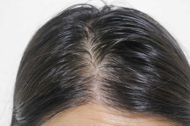 ドクターフォーヘア ポリゼン シークニング スカルプ セラム 1週目体験談