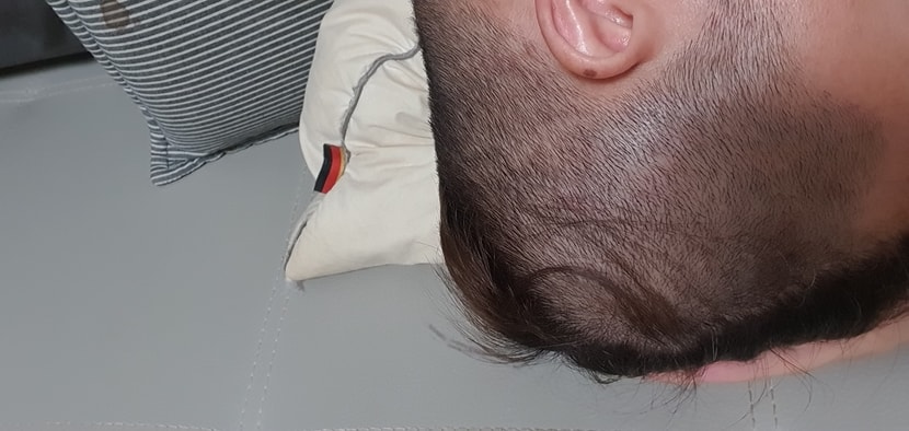 스케일러 사용후