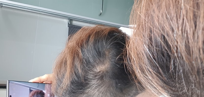 정수리 사진