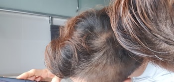 정수리 사진