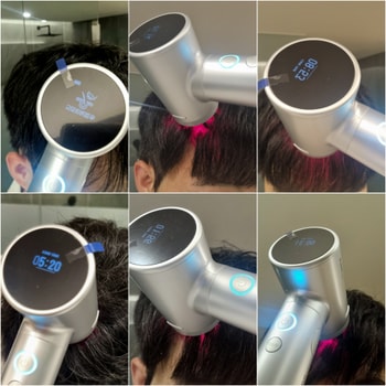 두피케어 모드 2