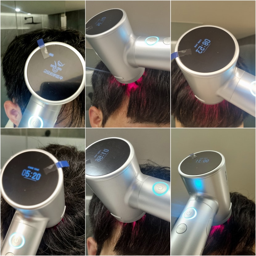 두피케어 모드 2