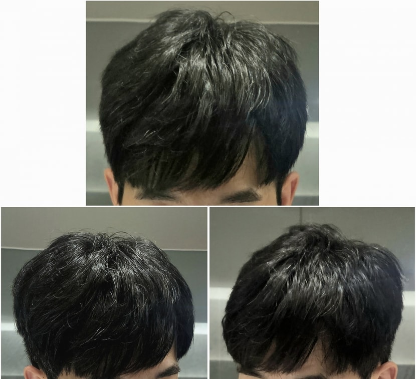현재 모발 상태