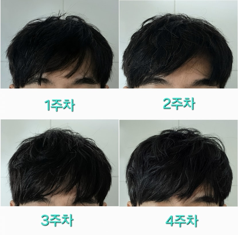 모발 주차별 사진비교