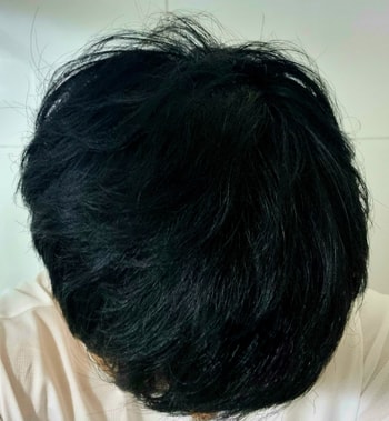 현재 모발상태