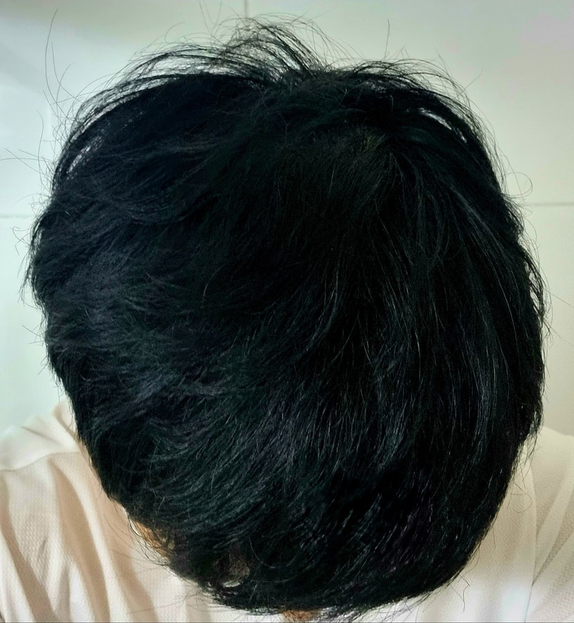 현재 모발상태
