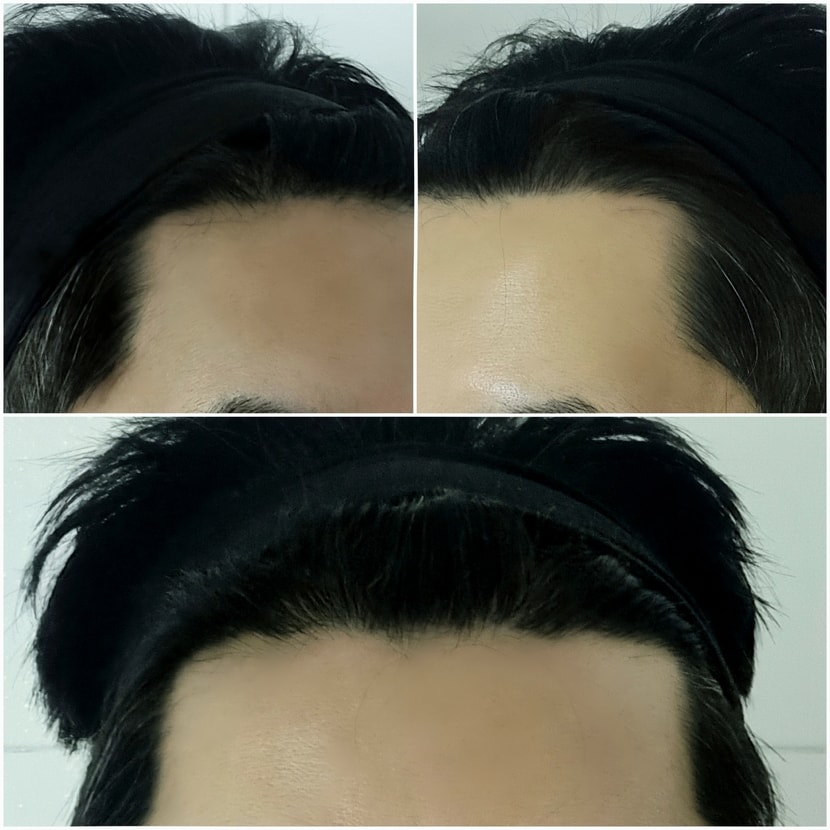 현재 모발상태 