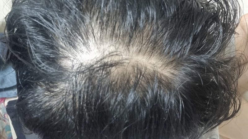 닥터포헤어 에센스 4주차 후기남겨요