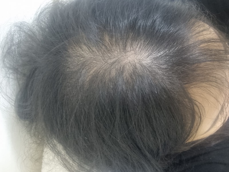 닥터포헤어 에센스 1주차 후기남겨요