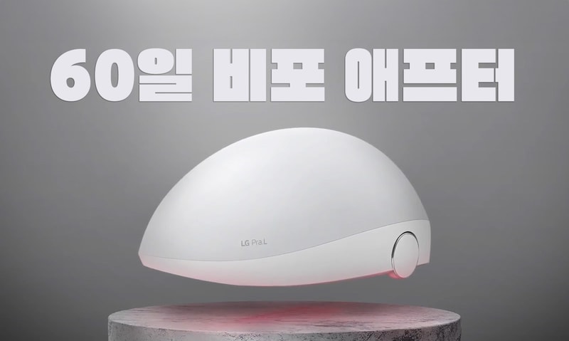 LG Pra.L 9주차 - 60일 비포 애프터 [17/24]