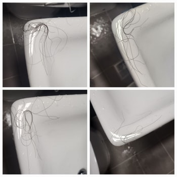 머리빠짐