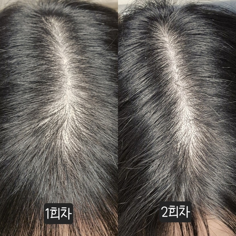2회차 기록
