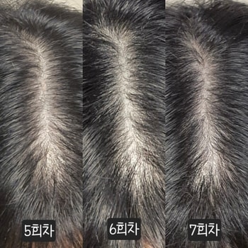 5-7회차후기