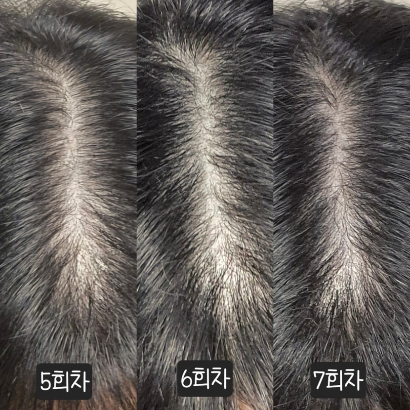 5-7회차후기