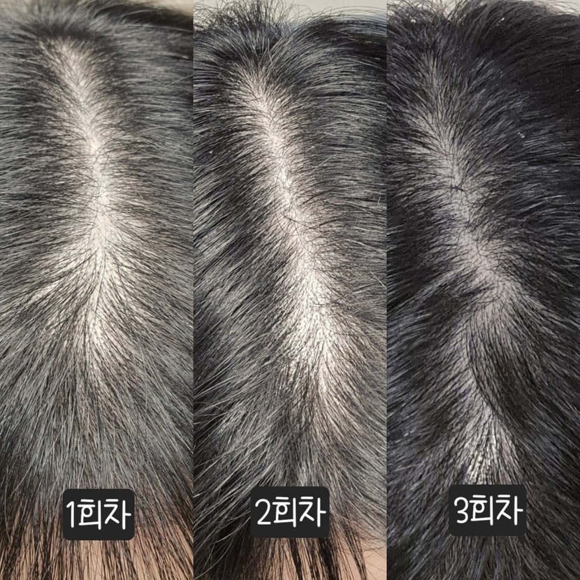 가르마 체크