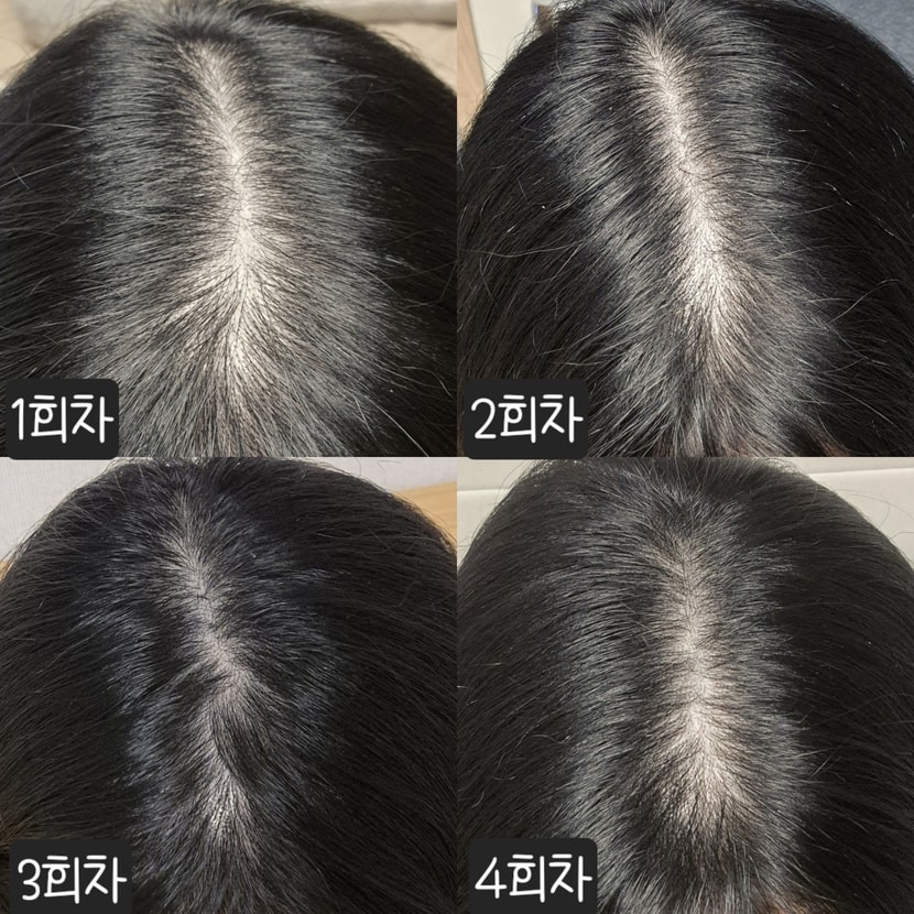 가르마 기록