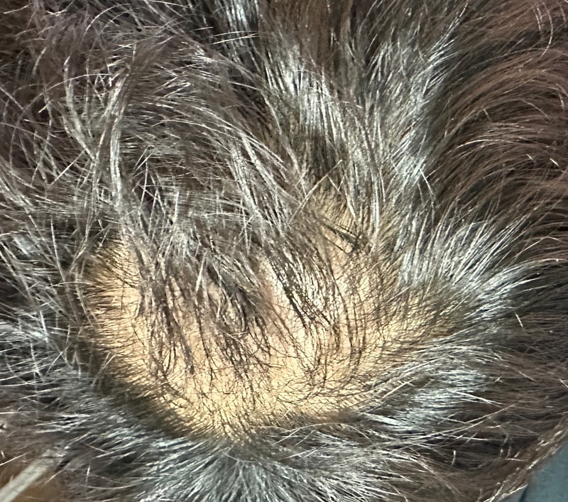 ブラックフォーレ クール ディープクリーン 1ヶ月 使用体験談