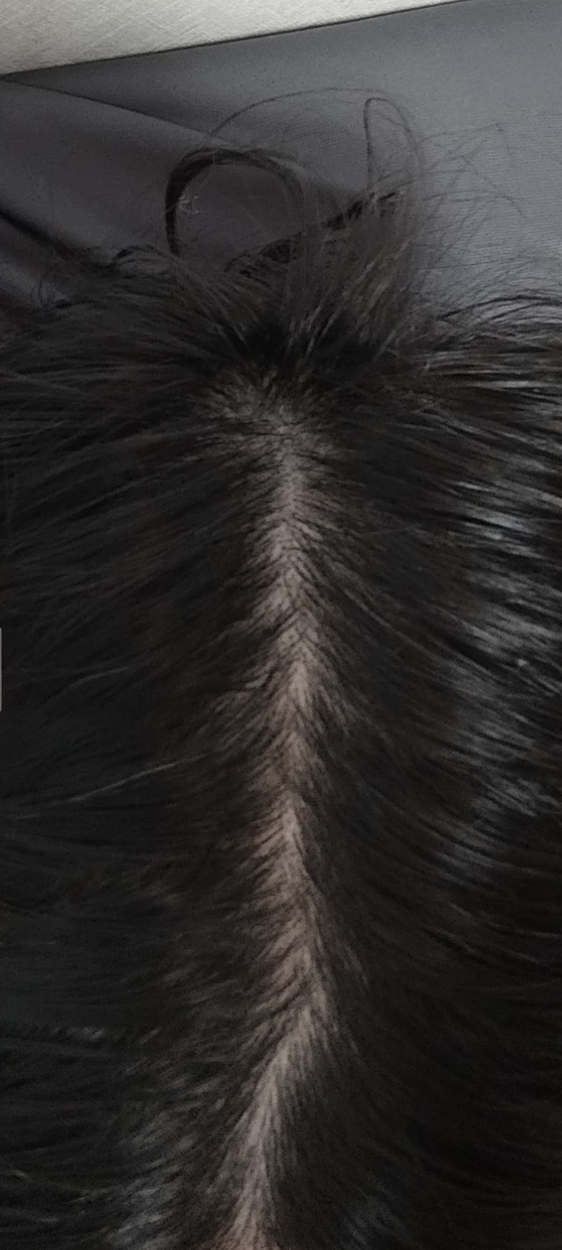 オンユビオチン3週目の体験談