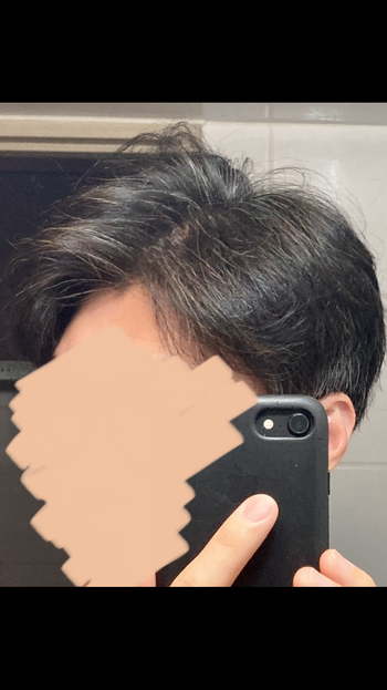 측면1