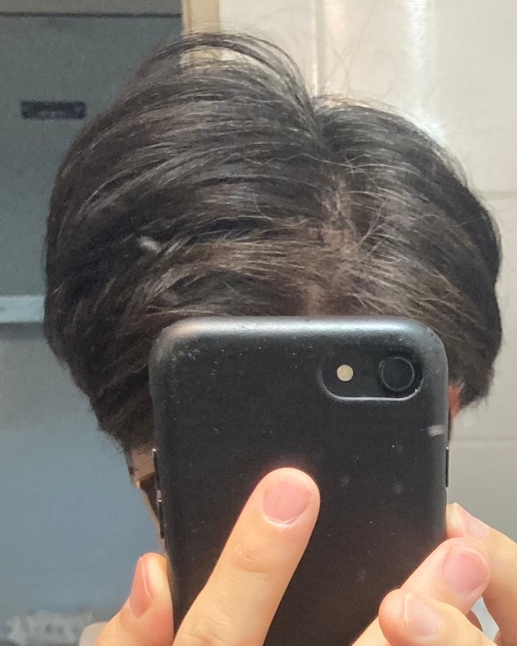 사용전 정수리2