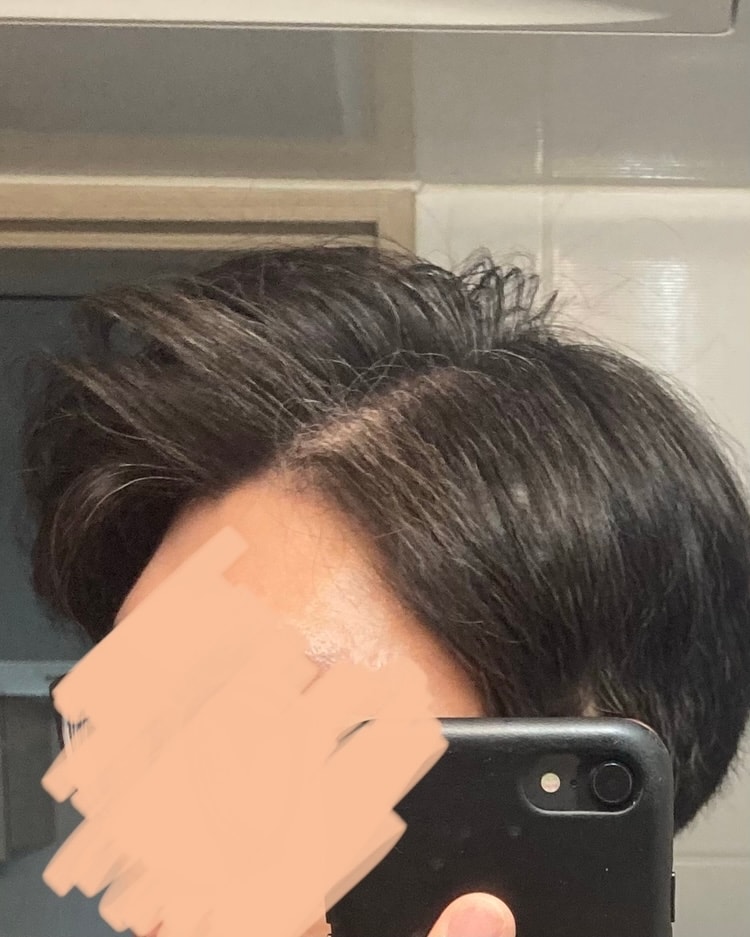 사용전 측면2