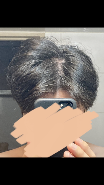 정수리