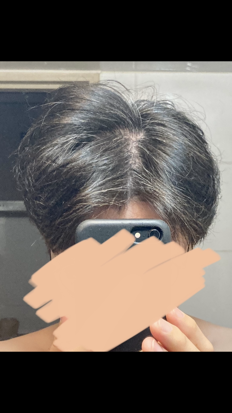정수리