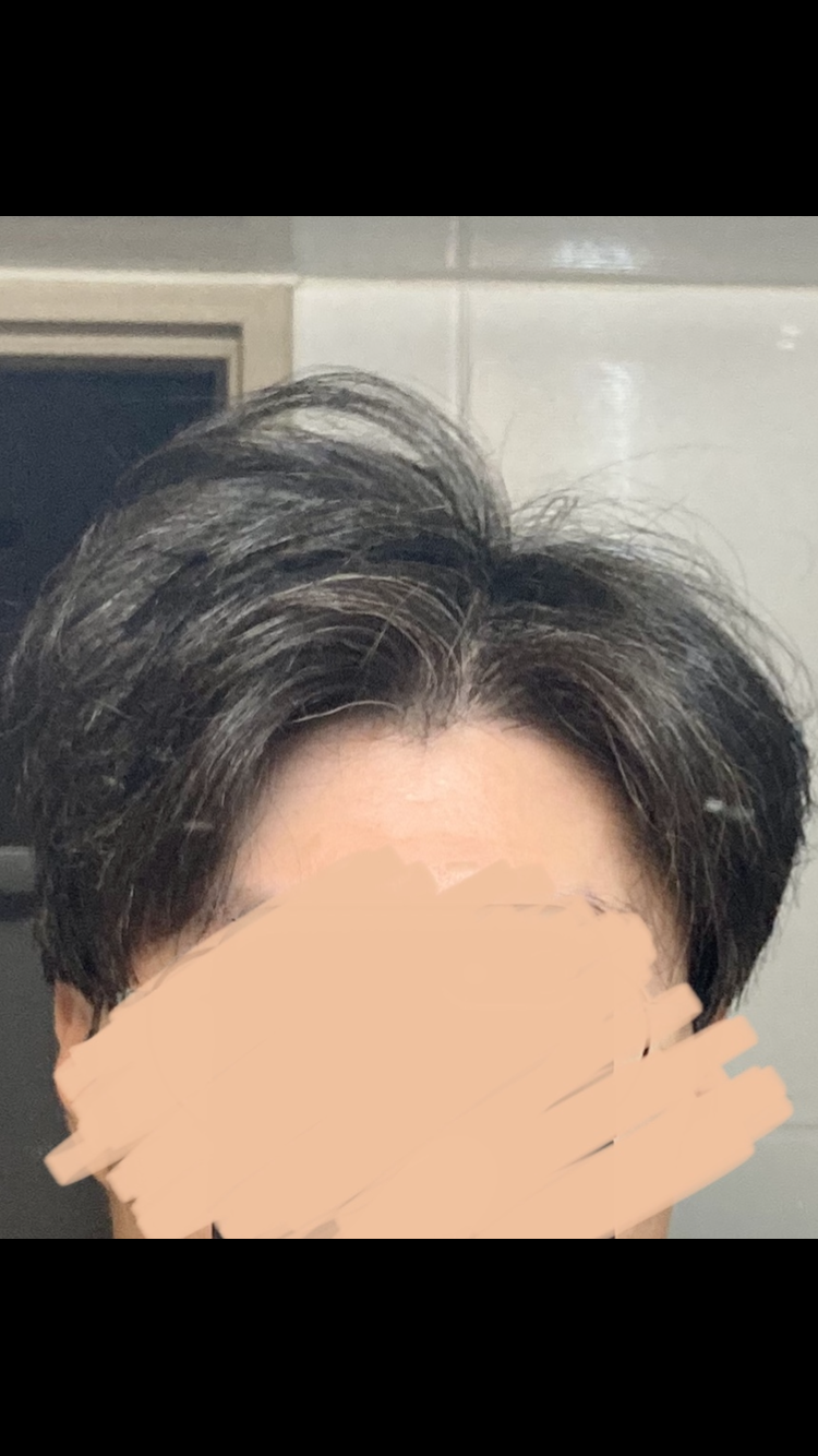 정면