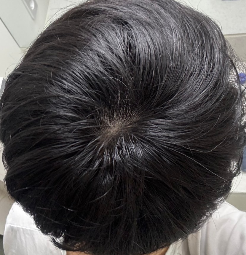 2주차