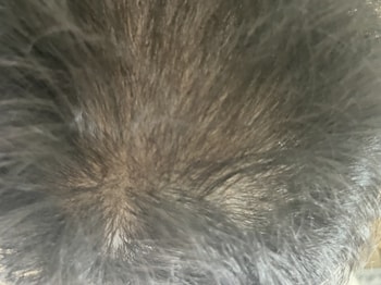 샴푸 후 머리, 4주차와 비교를 위해