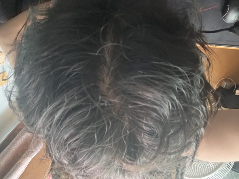 4주 첫번째 후기