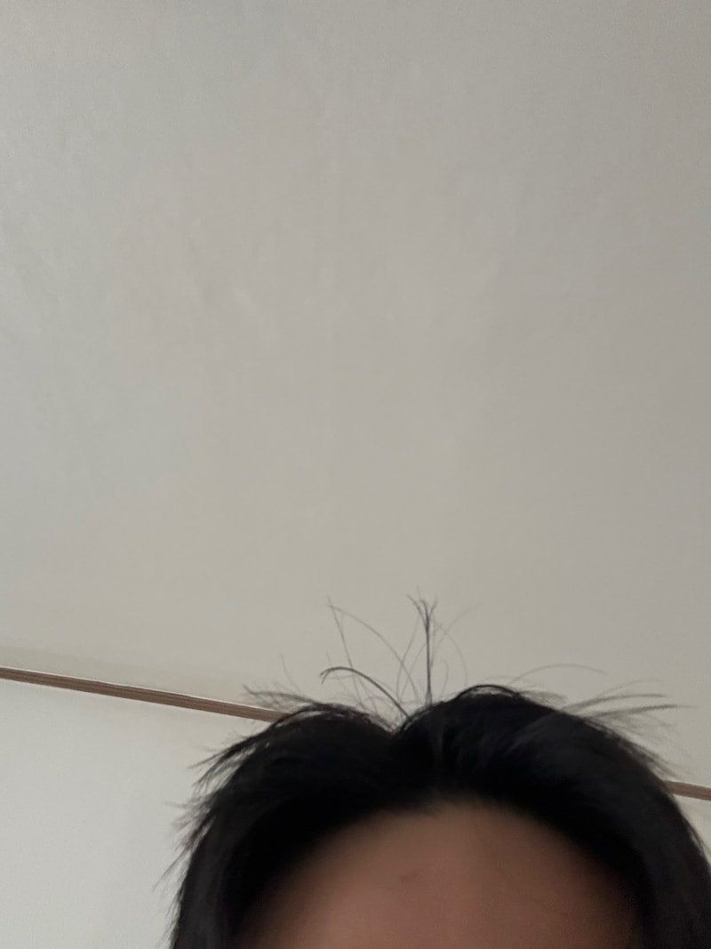 黑森林根动力洗发水第4周后期。