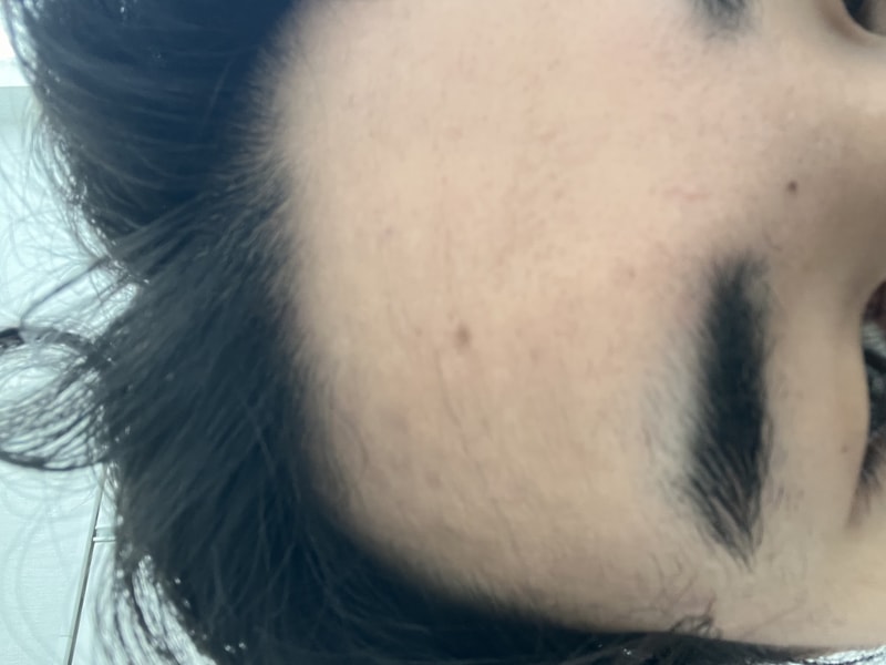 黑森林根动力洗发水第3周后期。