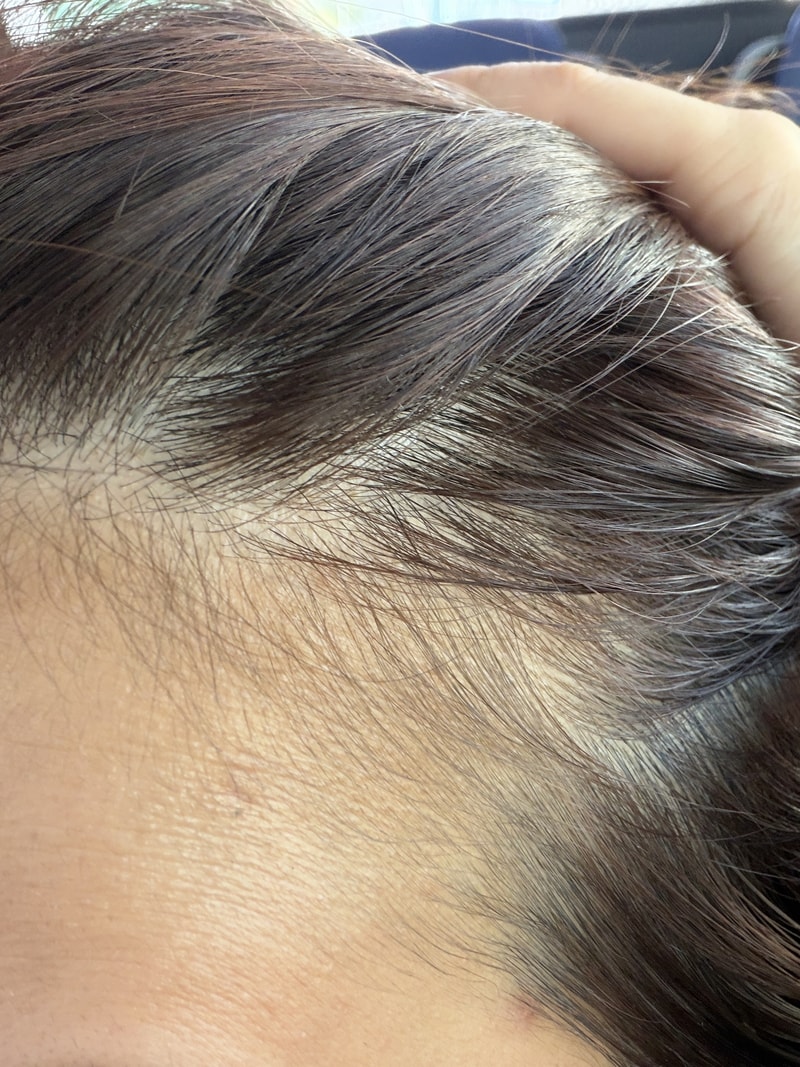 뉴프리미엄 TS 샴푸 3주차 후기입니다.