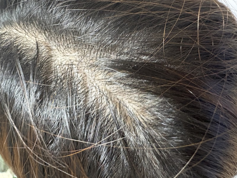 HAUM PGGM 탈모샴푸 2주차 후기