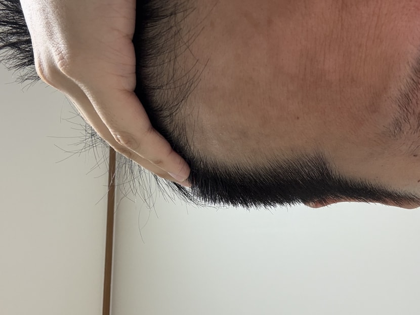 헤어미라클 시작 전
